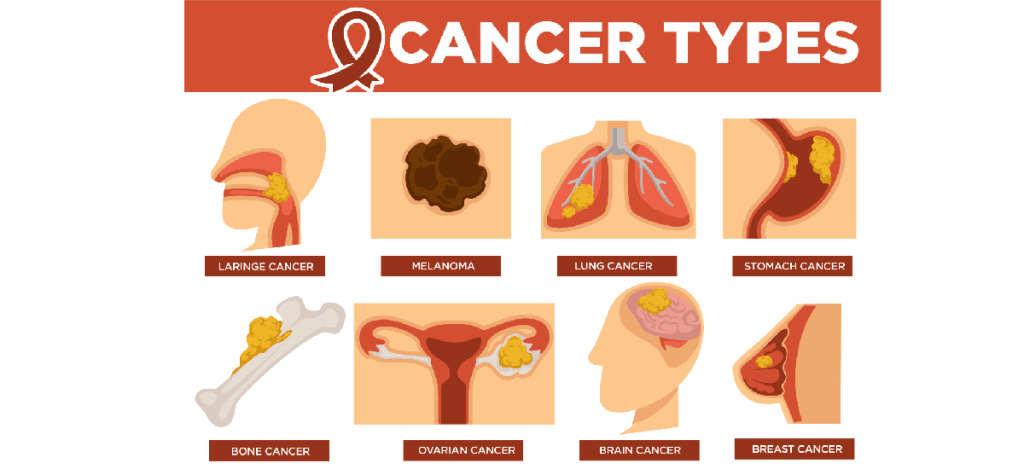 Common Types of Cancer: A Overview of Various Forms